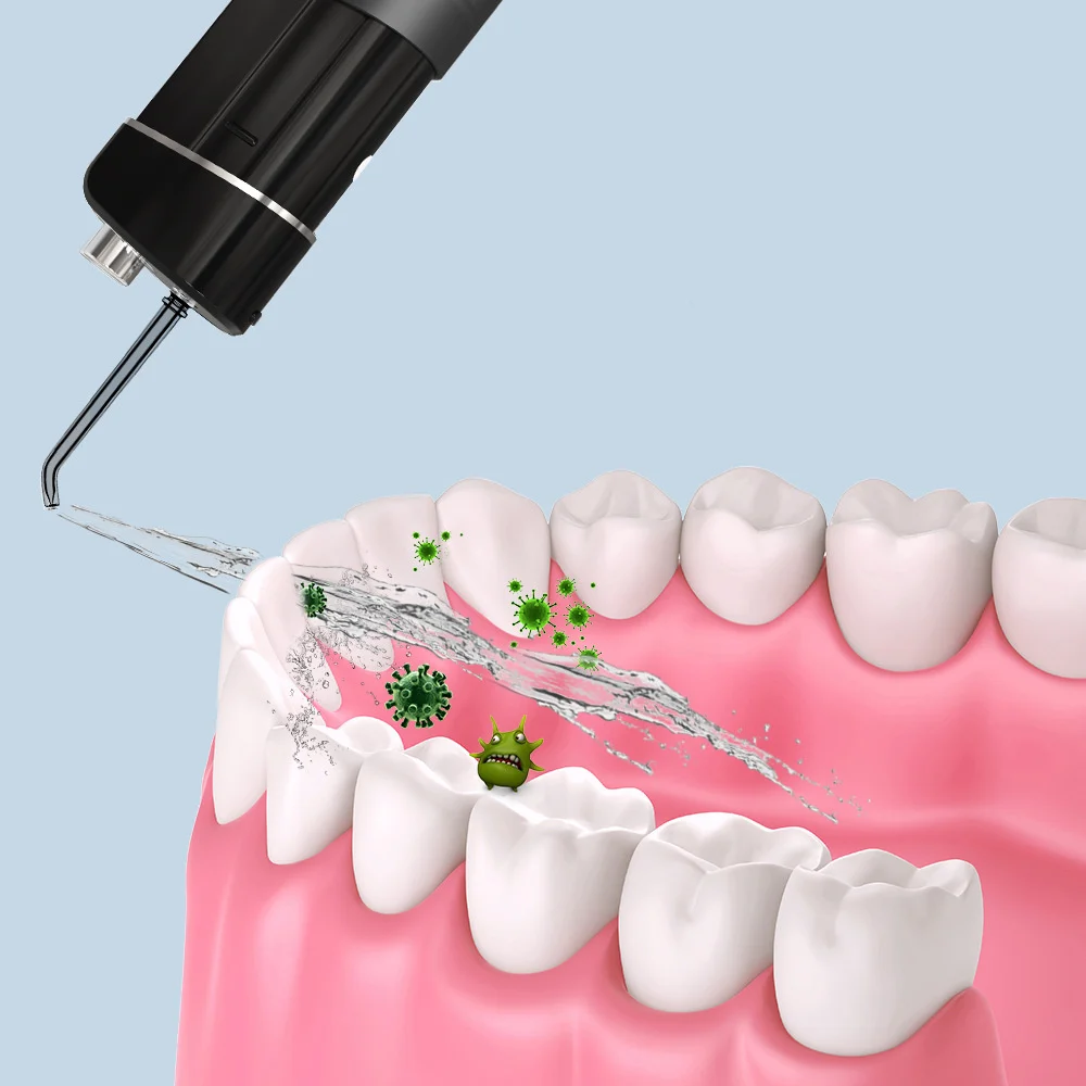 Home Calculus Pulse Orthodontic Water Flosser - Image 2
